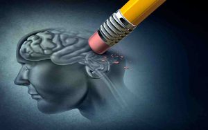 Neurologi Varoittaa: Nämä 3 Alzheimerin Taudin Oireita Ilmenee Ennen Muistinmenetystä