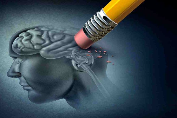 Neurologi
